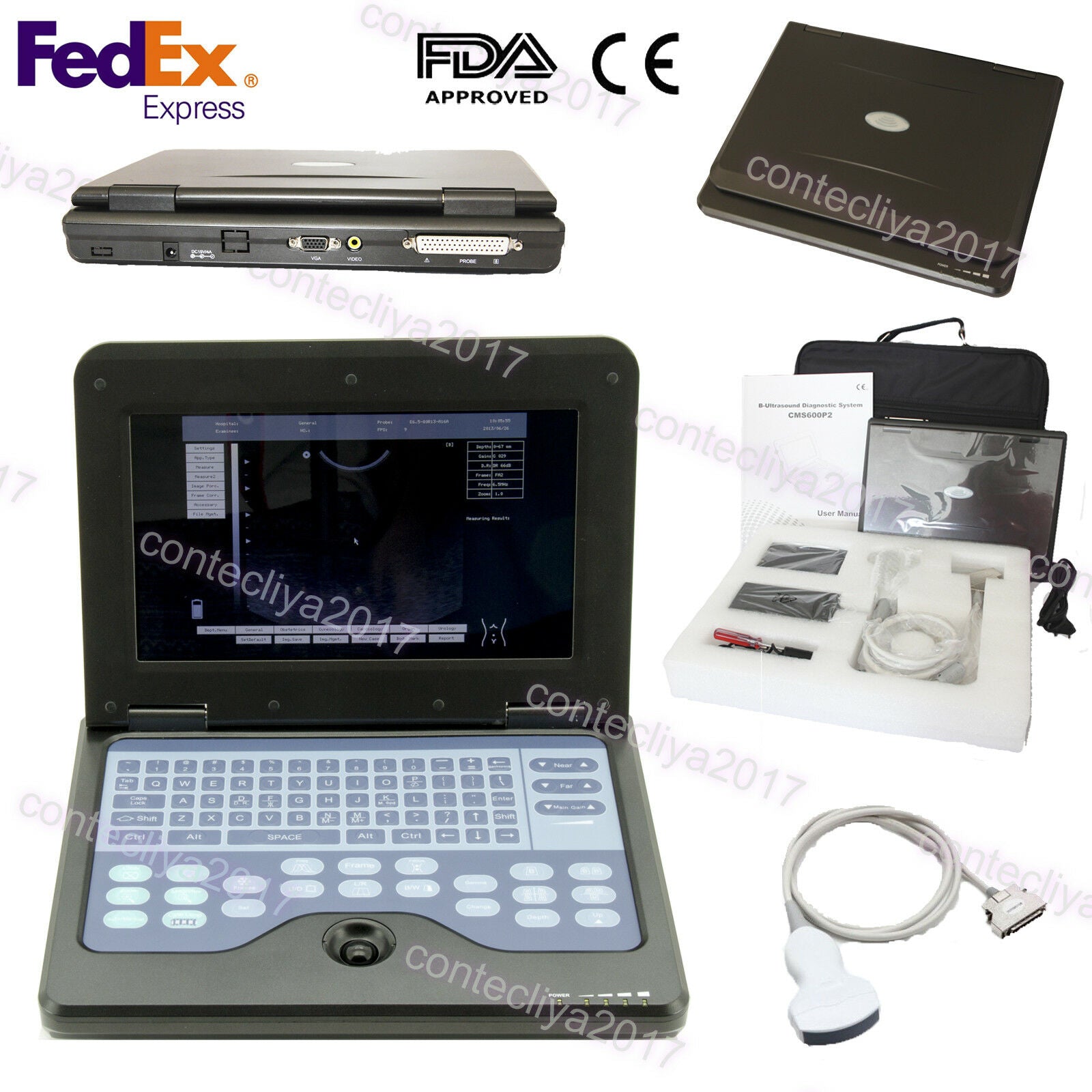 USA,Portable Ultrasound Scanner Laptop Machine Convex/Linear/Cardiac/Tranvaginal DIAGNOSTIC ULTRASOUND MACHINES FOR SALE