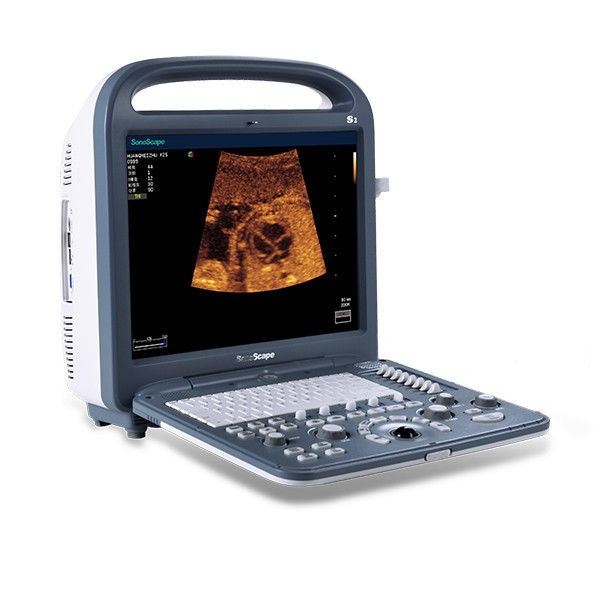 SONOSCAPE S2 3D/4D Portable Color Doppler System + Cardiac +Vascular probes..NEW DIAGNOSTIC ULTRASOUND MACHINES FOR SALE