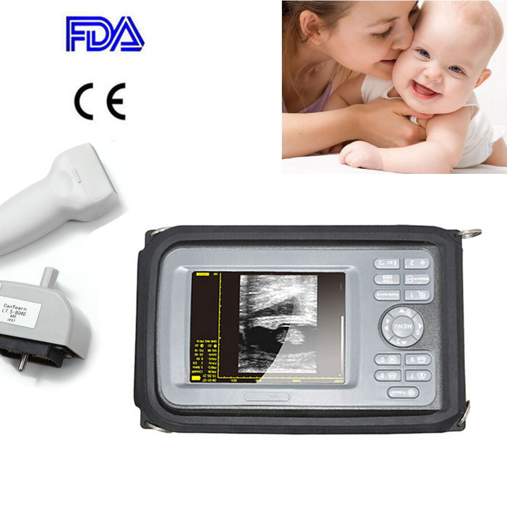 5.5 " Handheld Ultrasound Scanner/Machine  Digital +Linear Probe For Human CE DIAGNOSTIC ULTRASOUND MACHINES FOR SALE