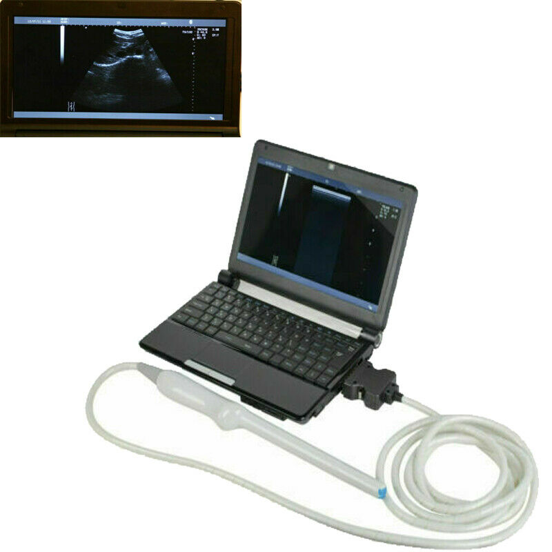 Laptop Ultrasound Scanner Machine+Transvaginal Probe+Micro Convex Probe ON SALE DIAGNOSTIC ULTRASOUND MACHINES FOR SALE