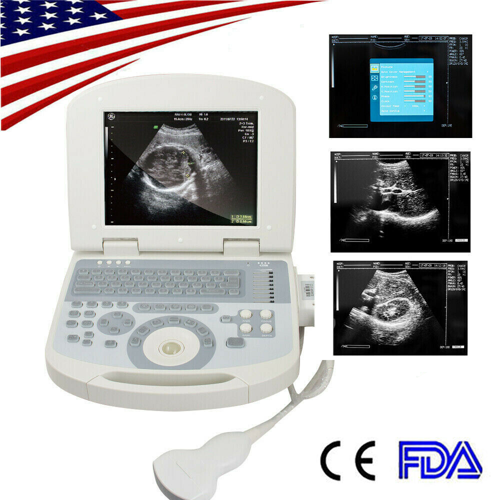 New Portable Laptop Machine Digital Ultrasound Scanner, 3.5 Micro Convex Probe DIAGNOSTIC ULTRASOUND MACHINES FOR SALE