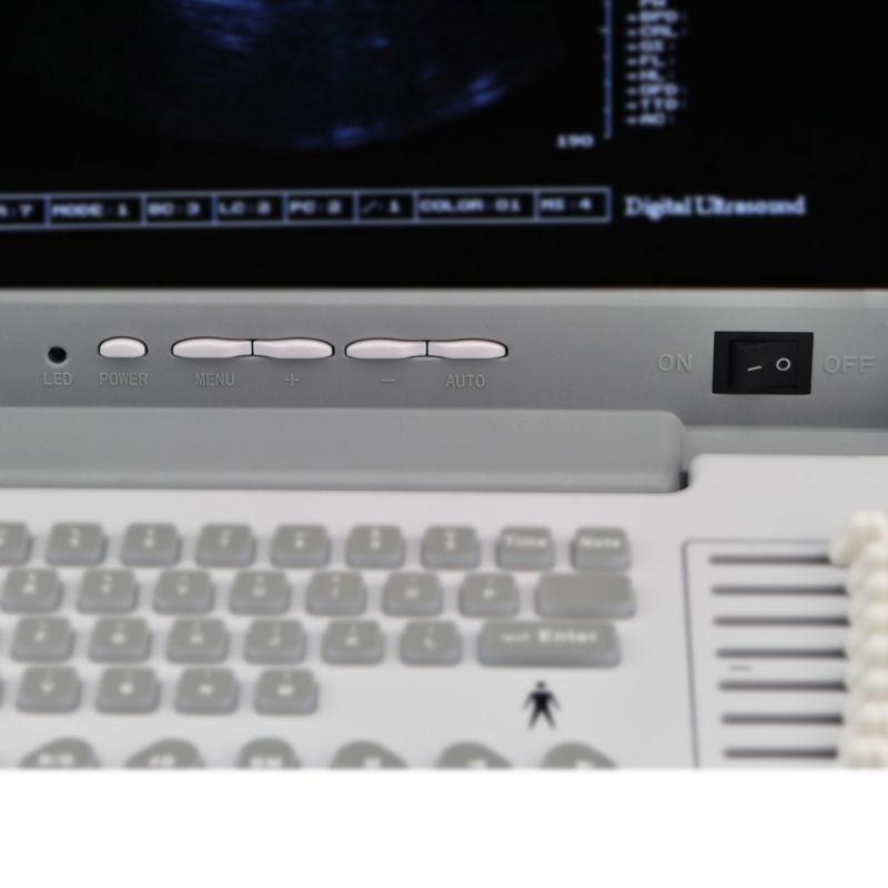 USA Updated Digital Ultrasound Scanner/Machine Convex & Transvaginal Probe 3D 190891287229 DIAGNOSTIC ULTRASOUND MACHINES FOR SALE