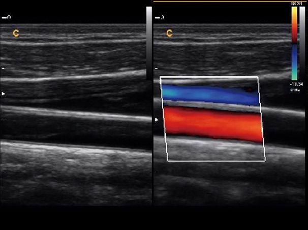 Chison Q9 Color Doppler Ultrasound Scanner & Two Probes Cardiac, Vascular DIAGNOSTIC ULTRASOUND MACHINES FOR SALE