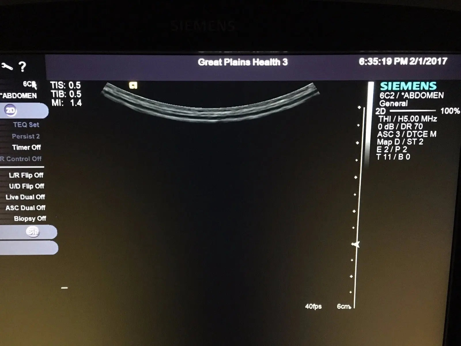 SIEMENS ACUSON S2000 Shared Service Ultrasound w/ 4V1C, 6C2, and EV8C4 Probe DIAGNOSTIC ULTRASOUND MACHINES FOR SALE