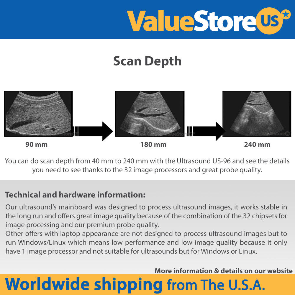 Ultrasound Scanner Veterinary Pregnancy US-96 with 3.5 MHz Convex Probe. DIAGNOSTIC ULTRASOUND MACHINES FOR SALE