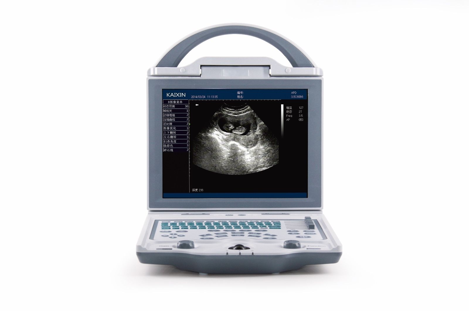 Newest-Light weight Portable Ultrasound&one Probe, DICOM, Battery, LED screen DIAGNOSTIC ULTRASOUND MACHINES FOR SALE