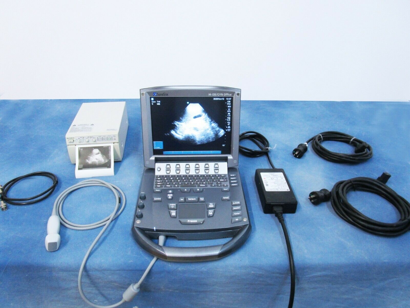 Sonosite M-Turbo Ultrasound System Complete - 60 Day Warranty DIAGNOSTIC ULTRASOUND MACHINES FOR SALE