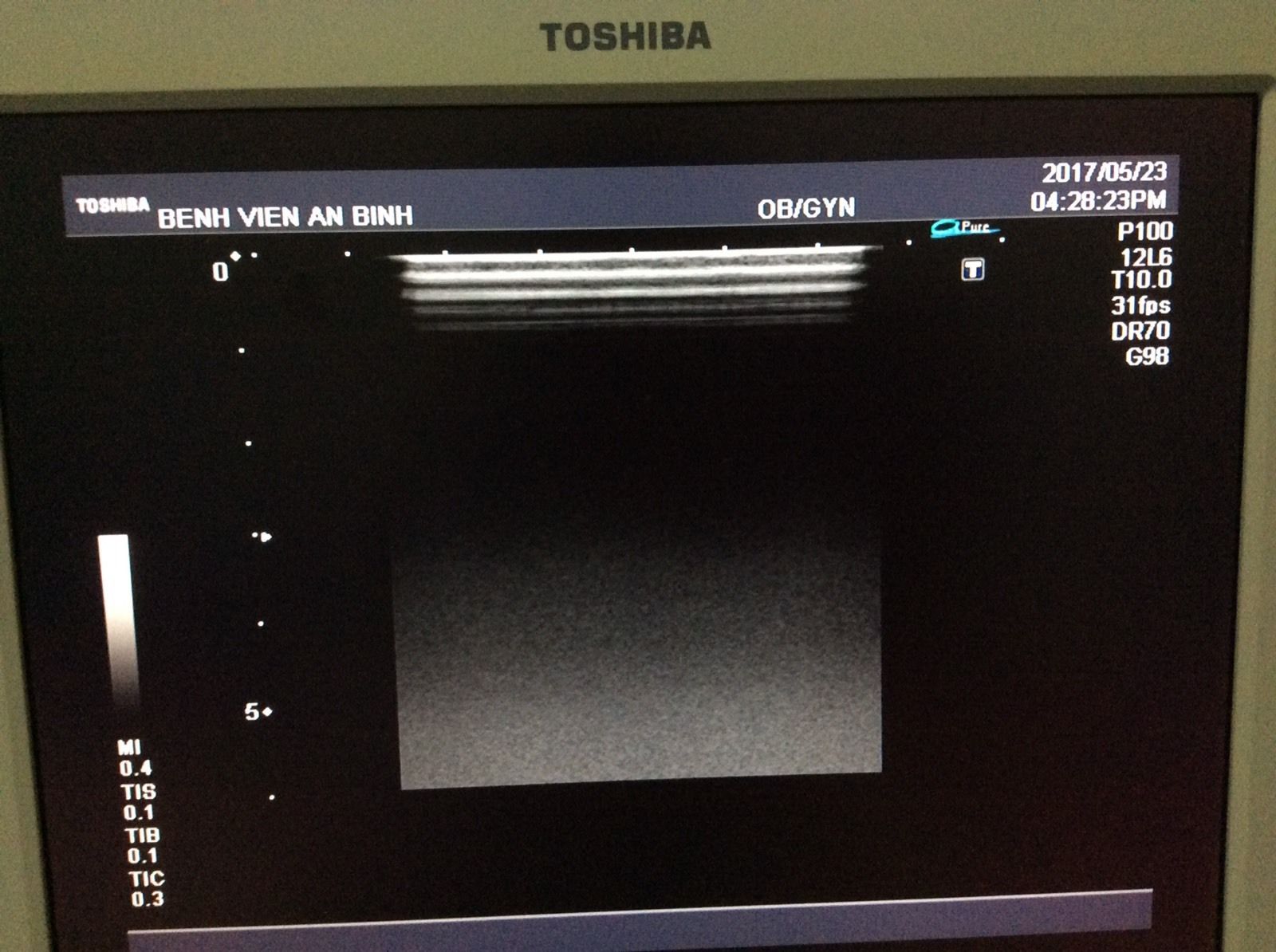 Toshiba Ultrasound transducer probe linear PLM-805AT DIAGNOSTIC ULTRASOUND MACHINES FOR SALE