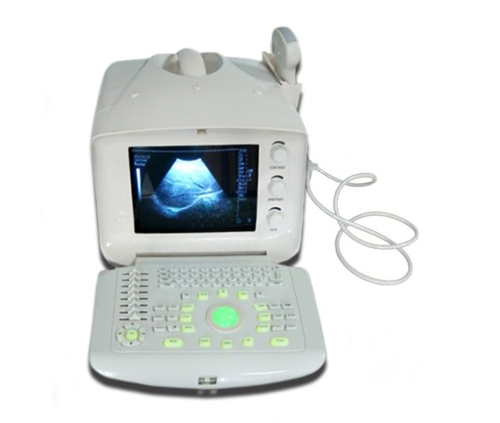 Clinic 3D Digital Ultrasound Machine Scanner System Monotor Convex +Linear Probe DIAGNOSTIC ULTRASOUND MACHINES FOR SALE