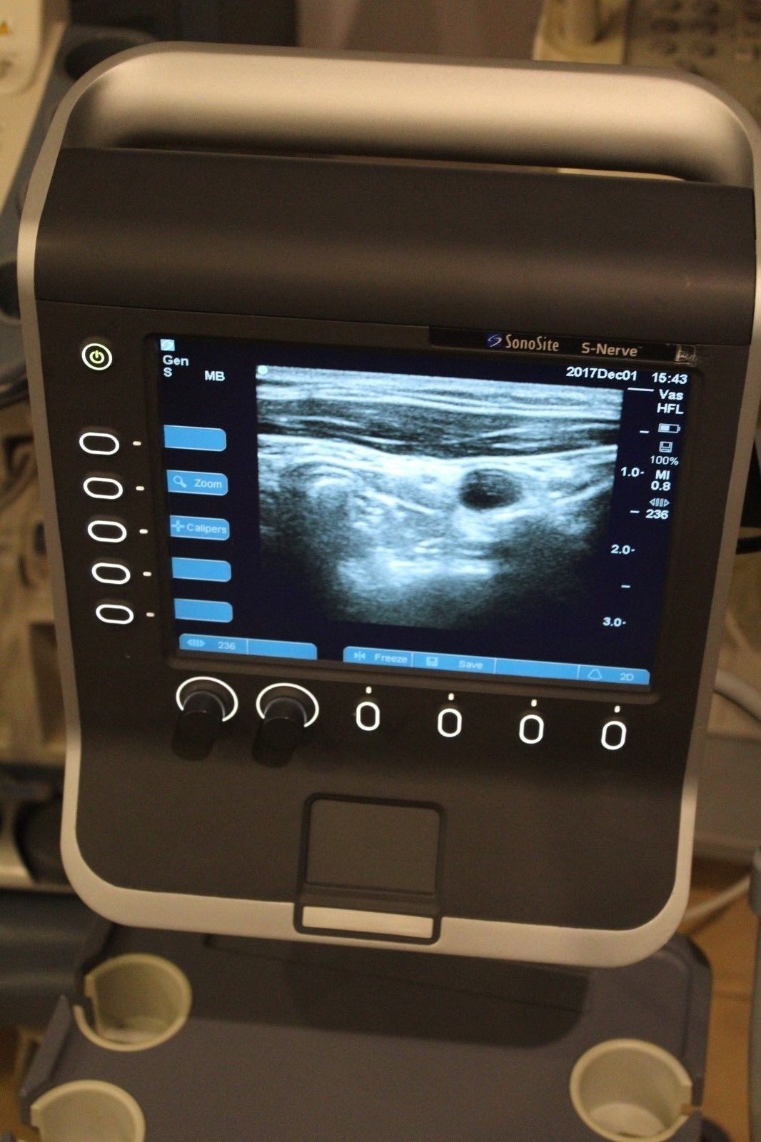 Sonosite S-Nerve vascular/nerve ultrasound with HFL38x-13-6 MHz transducer DIAGNOSTIC ULTRASOUND MACHINES FOR SALE