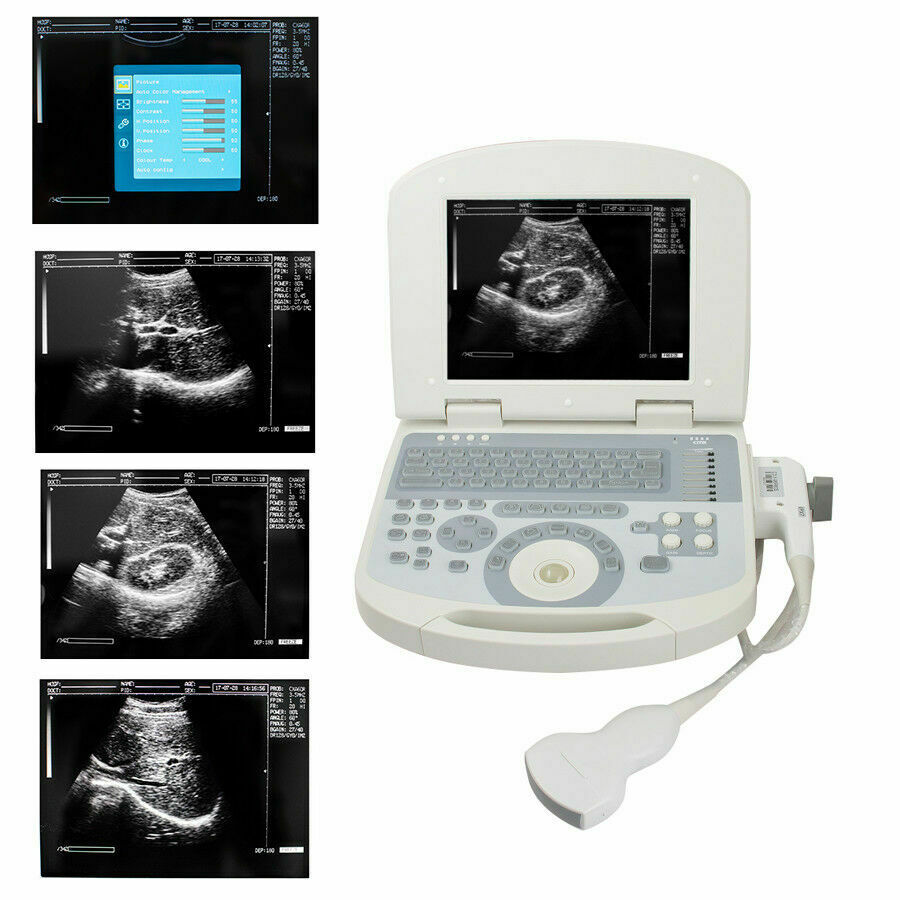 Portable Medical Laptop Diagnostic Ultrasound Scanner 3.5 Convex probe+Free 3D DIAGNOSTIC ULTRASOUND MACHINES FOR SALE