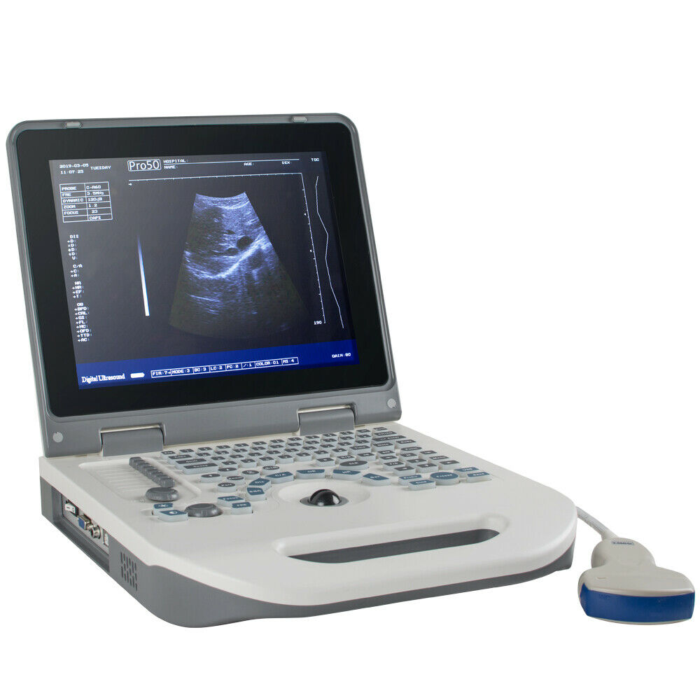Portable Laptop Digital Ultrasound Scanner Machine System +Convex Probe +Battery DIAGNOSTIC ULTRASOUND MACHINES FOR SALE