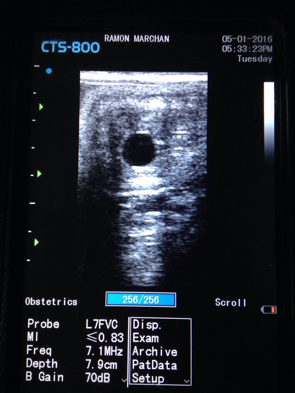 SIUI CTS-800 Veterinary Ultrasound with Rectal Linear Probe DIAGNOSTIC ULTRASOUND MACHINES FOR SALE