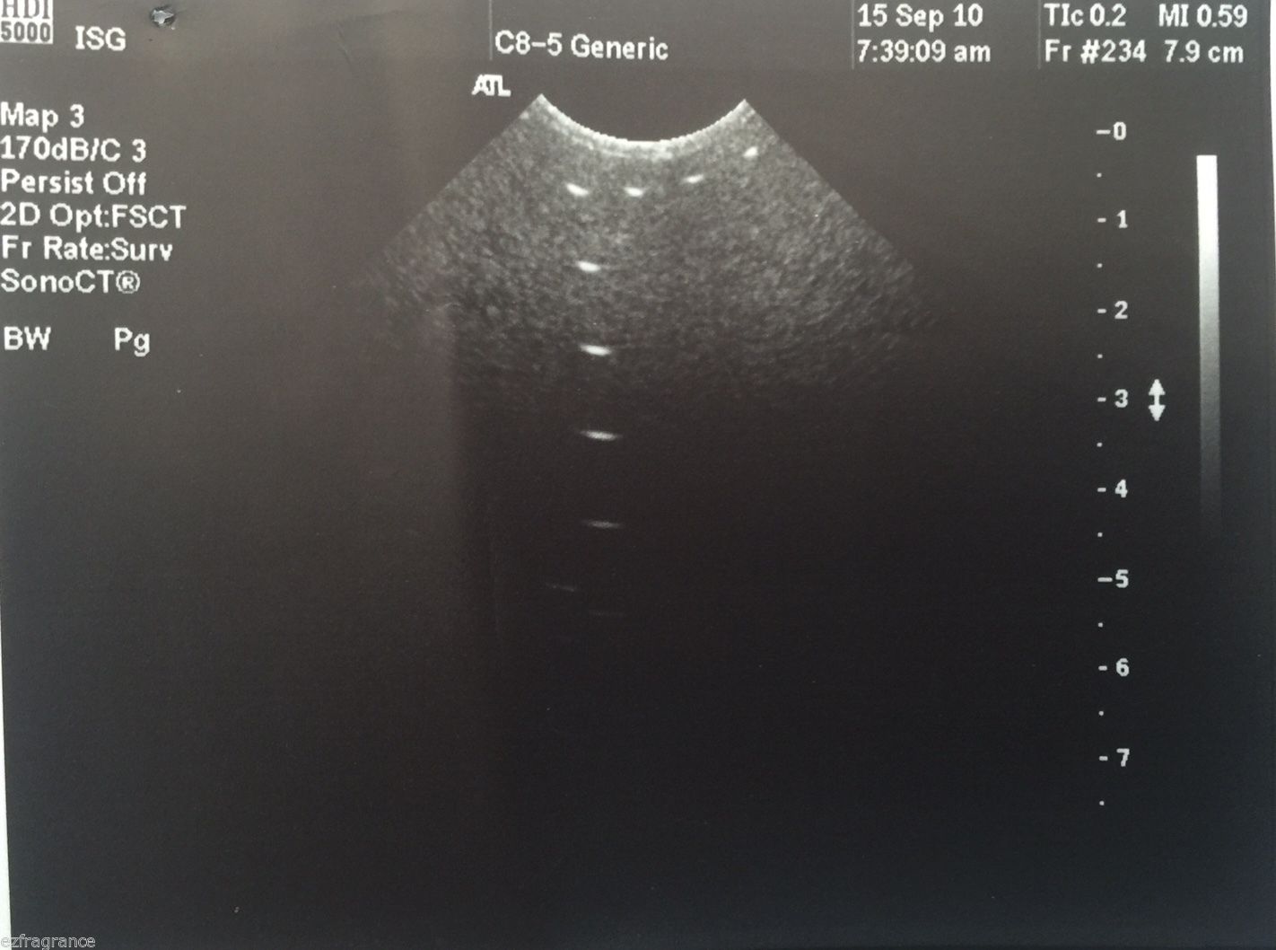 probe ultrasound monitor imaging