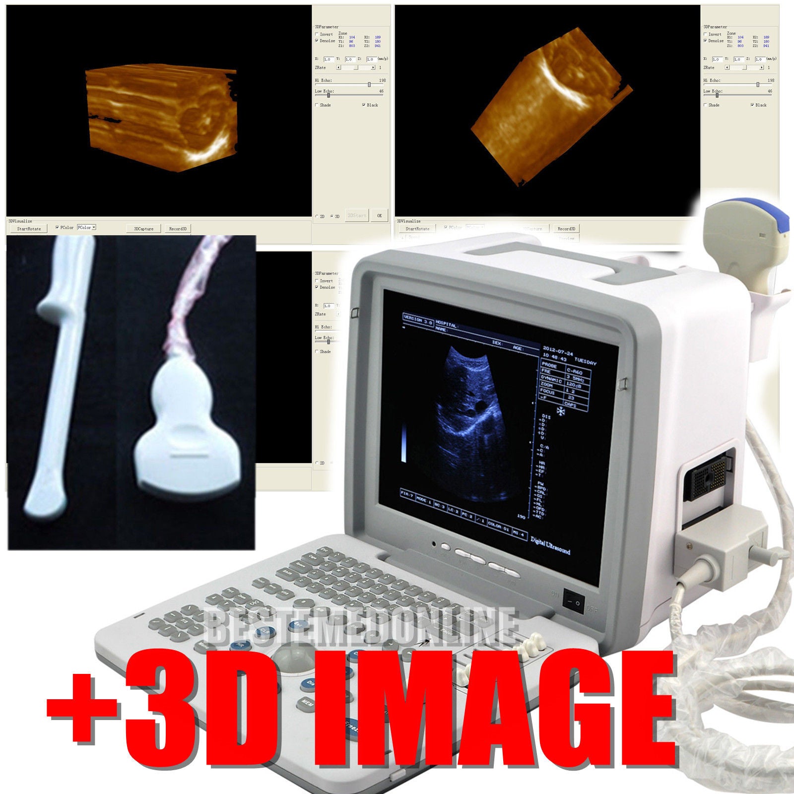 Portable Ultrasound Machine Scanner System Convex Probe+Transvaginal 3D Version 190891055620 DIAGNOSTIC ULTRASOUND MACHINES FOR SALE