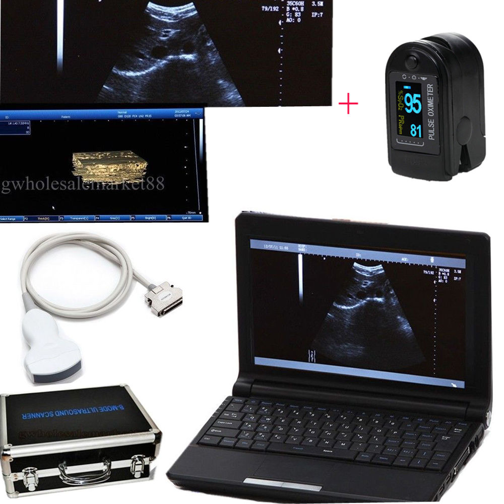 Portable Laptop Ultrasound Scanner Machine 3.5M Convex Probe 3D+US SPO2 Oximeter 190891041722 DIAGNOSTIC ULTRASOUND MACHINES FOR SALE