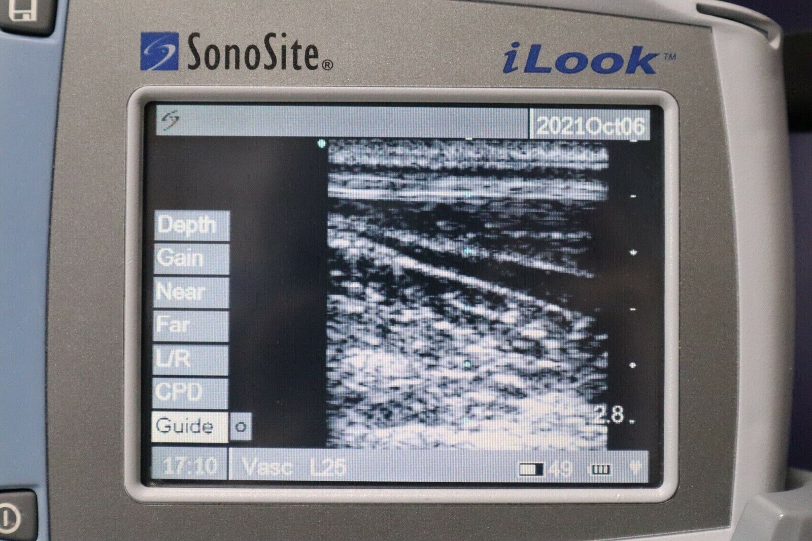 SONOSITE iLOOK PORTABLE ULTRASOUND SYSTEM DIAGNOSTIC ULTRASOUND MACHINES FOR SALE