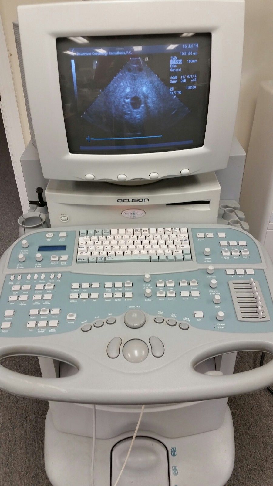 Seimens - Acuson Sequoia C256 Ultrasound System with 3V2c Cardiac Probe DIAGNOSTIC ULTRASOUND MACHINES FOR SALE