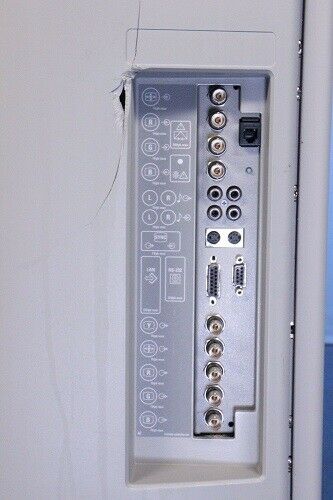 Siemens Sonoline Elegra Ultrasound with Transducer 5133330-L900U DIAGNOSTIC ULTRASOUND MACHINES FOR SALE