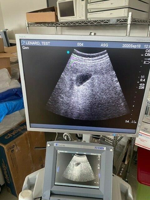 2008 Sonosite Titan Ultrasound system with Docking cart 19" Monitor DIAGNOSTIC ULTRASOUND MACHINES FOR SALE