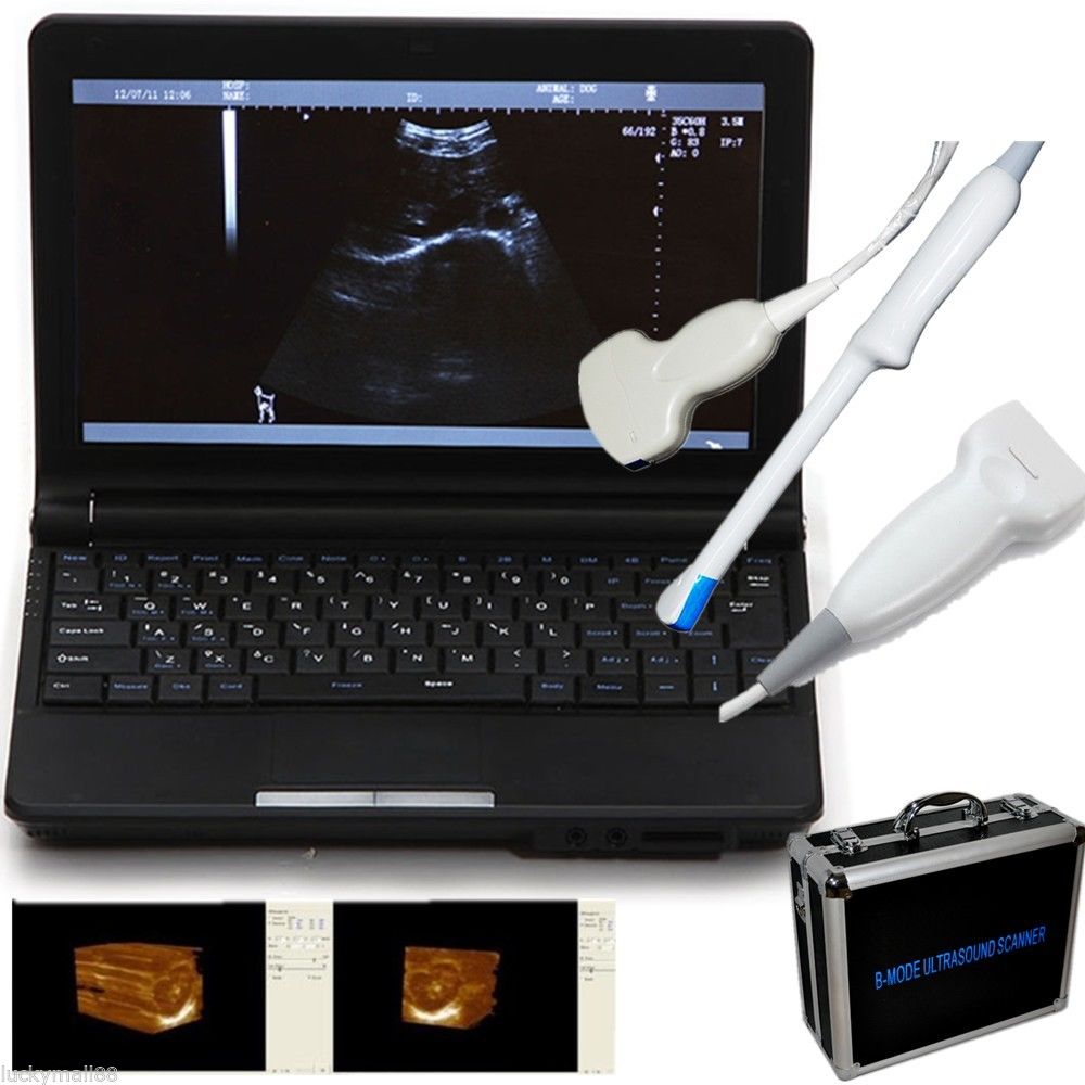 Ultrasound Scanner Machine System Convex Linear Transvaginal 3 Probe + Case Kit 190891046307 DIAGNOSTIC ULTRASOUND MACHINES FOR SALE