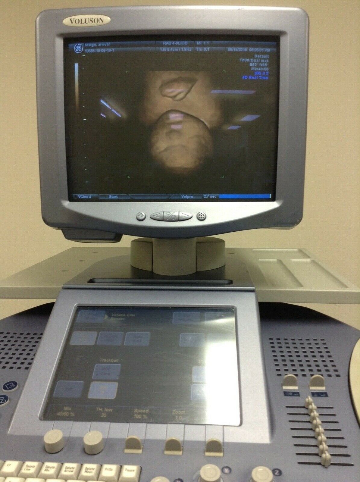 GE Voluson 730 Expert Ultrasound System BT08 DIAGNOSTIC ULTRASOUND MACHINES FOR SALE