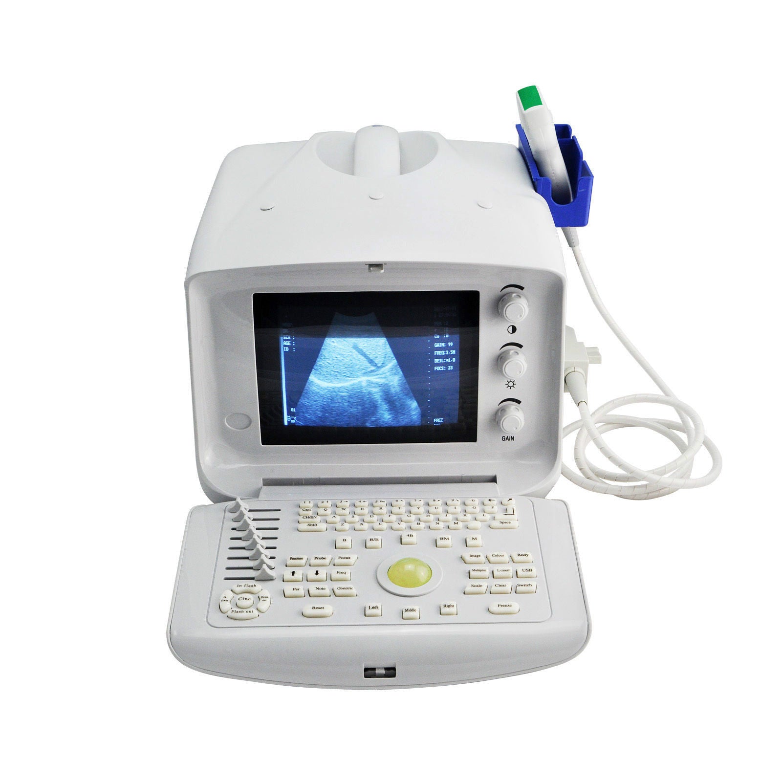 Portable Machine Digital Ultrasound Scanner Transvaginal Probe -Free 3D Software 190891982230 DIAGNOSTIC ULTRASOUND MACHINES FOR SALE
