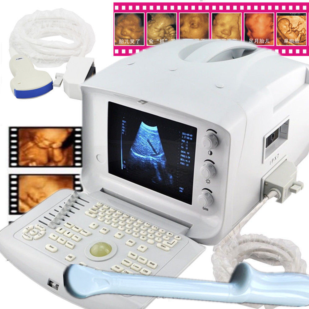 Ultrasound Scanner/Machine Convex Abdomen &Transvaginal Gynecology Probes 3D DIAGNOSTIC ULTRASOUND MACHINES FOR SALE