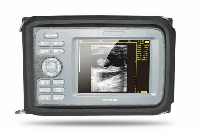 5.5inch Portable Ultrasound Scanner/Machine Digital+Convex Transducer Human Use DIAGNOSTIC ULTRASOUND MACHINES FOR SALE