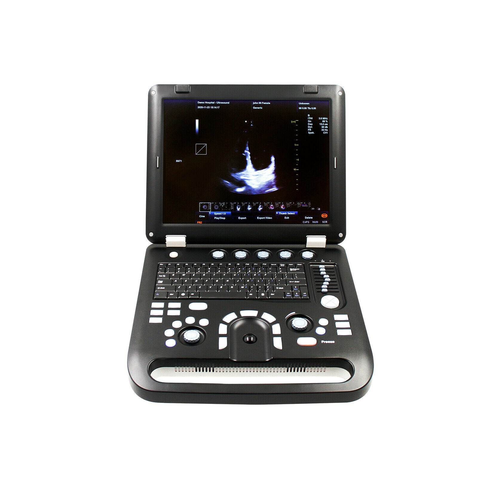 Portable Ultrasound Scanner Color Doppler Machine+ Convex Probe, PW CW,USB+Video DIAGNOSTIC ULTRASOUND MACHINES FOR SALE