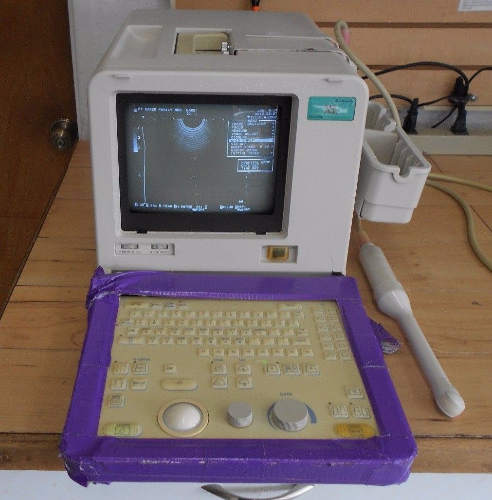 SHIMADZU SDU-350 XL Ultrasound With 2 Probes - Damaged - Turned On* DIAGNOSTIC ULTRASOUND MACHINES FOR SALE