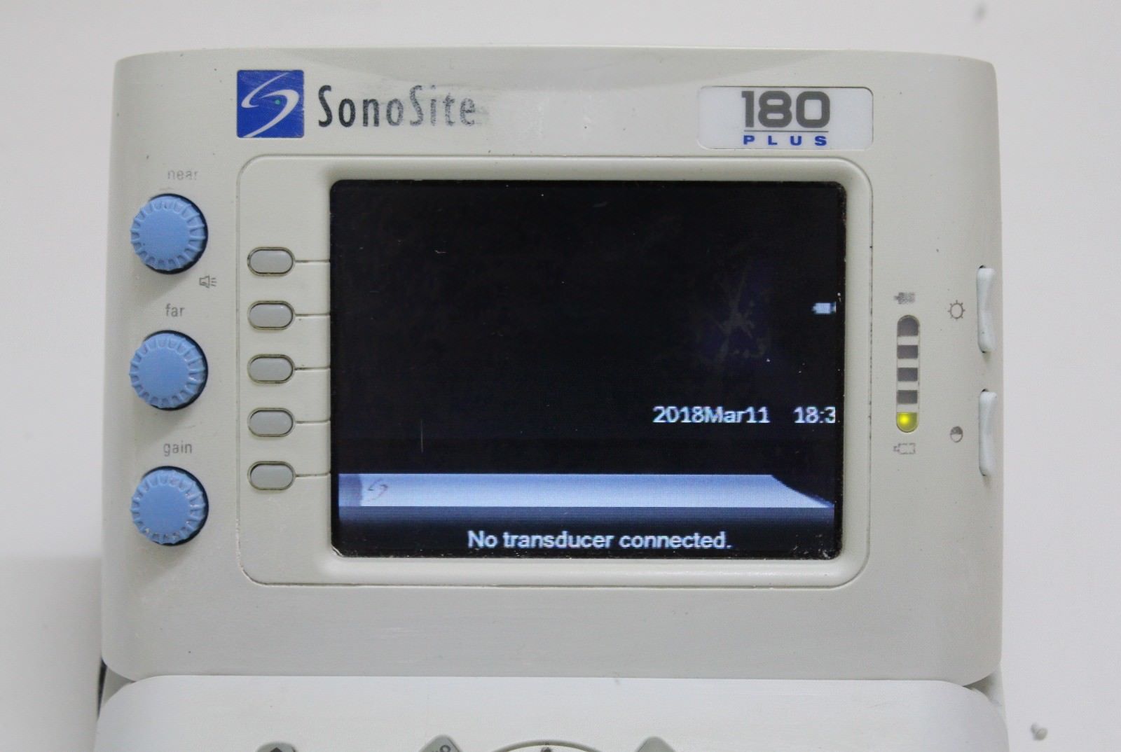 Sonosite 180 Plus Ultrasound (please read) DIAGNOSTIC ULTRASOUND MACHINES FOR SALE