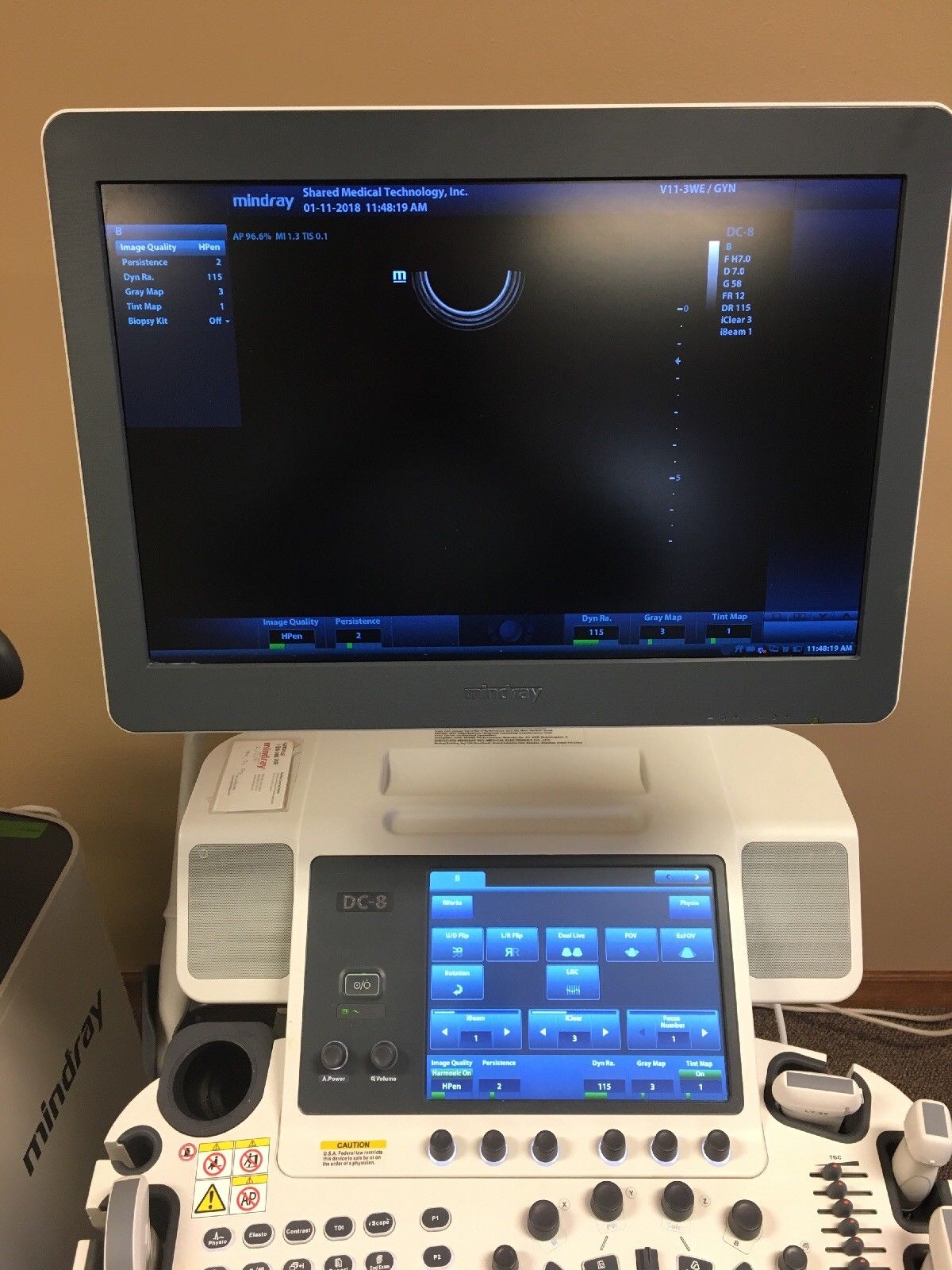 Mindray ultrasound dc-8 DIAGNOSTIC ULTRASOUND MACHINES FOR SALE