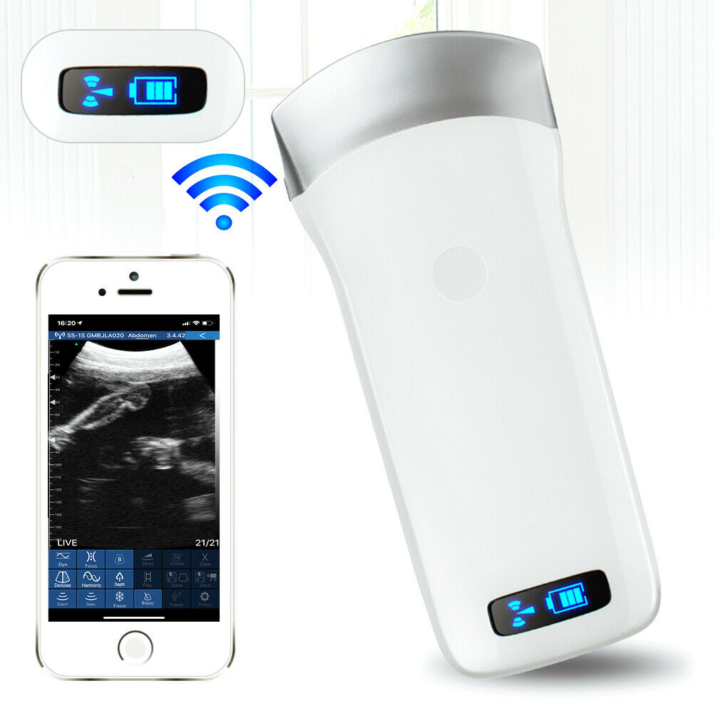 Ultrasound scanner Convex Probe Wifi IOS Android Electronic array 3.5Mhz Digital DIAGNOSTIC ULTRASOUND MACHINES FOR SALE