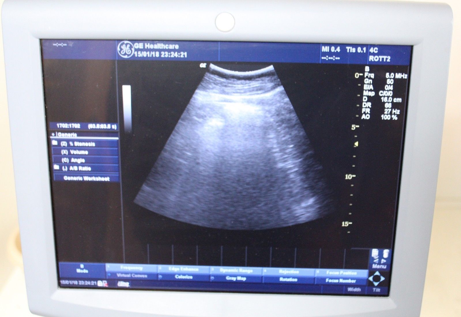 GE Logiq P5 Ultrasound System with 2 Probes DIAGNOSTIC ULTRASOUND MACHINES FOR SALE