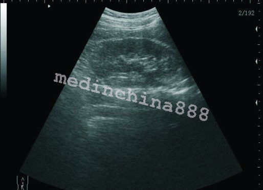 Laptop Ultrasound Scanner +Convex+Linear+Transvaginal 3 Probes Free Aluminum Box DIAGNOSTIC ULTRASOUND MACHINES FOR SALE