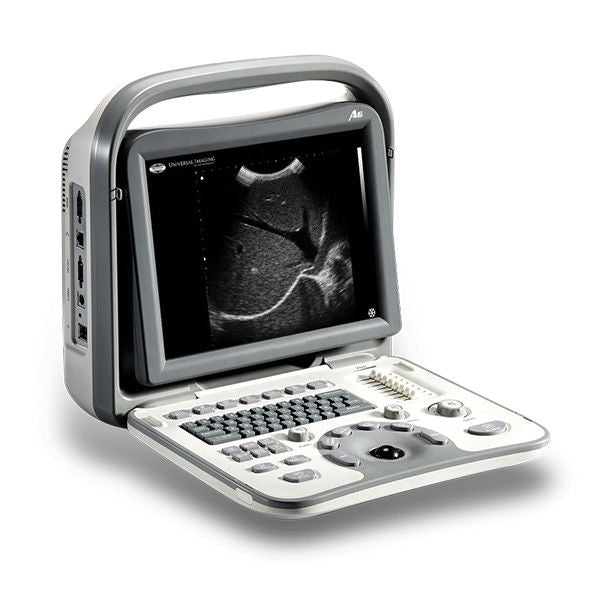 Sonoscape A6 portable ultrasound NEW (demo) with carrying case DIAGNOSTIC ULTRASOUND MACHINES FOR SALE