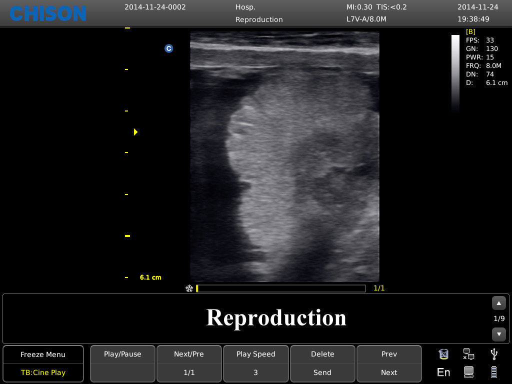 Chison ECO3 Ultrasound w/ 1 Probes and Accredited Veterinary Online Training DIAGNOSTIC ULTRASOUND MACHINES FOR SALE