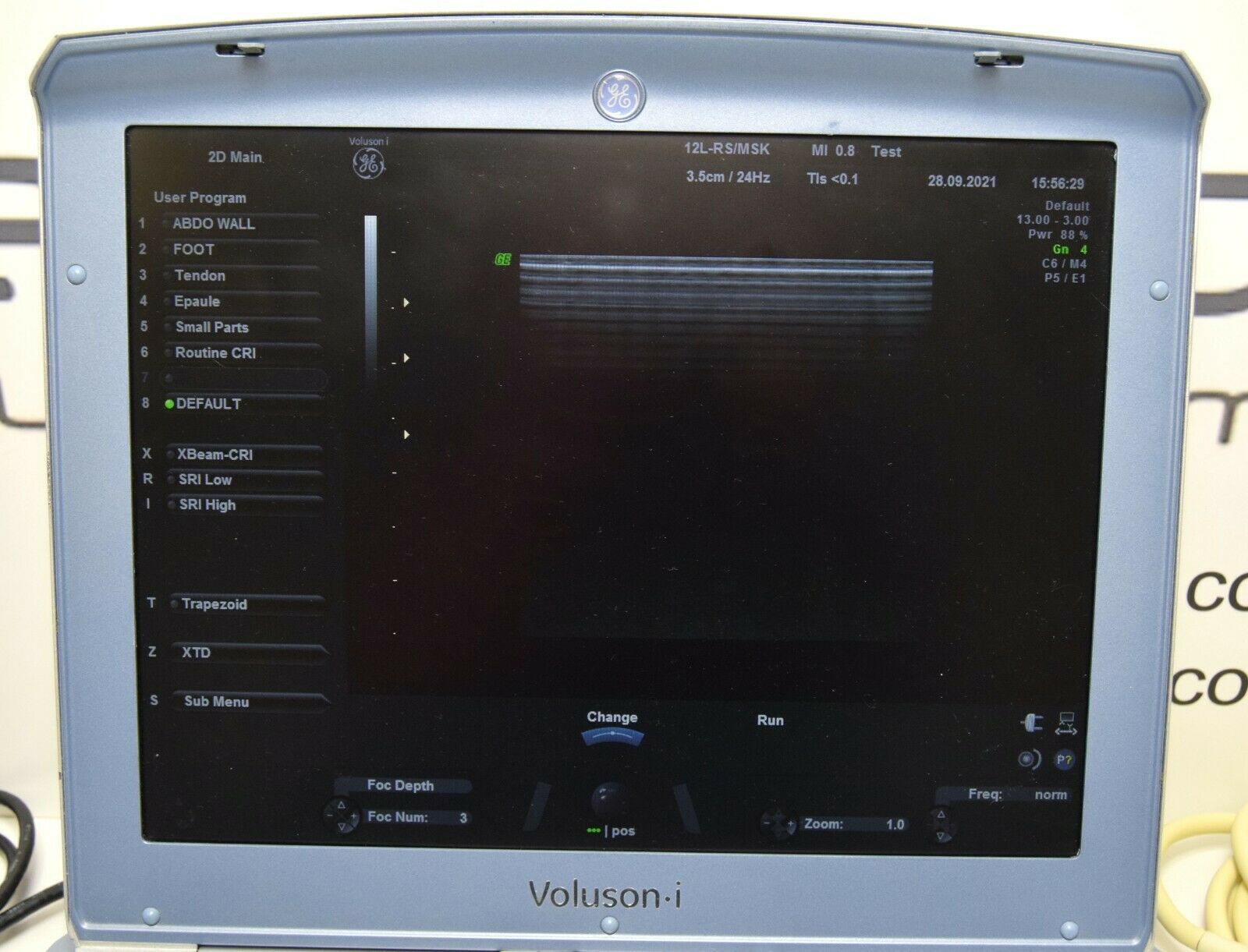 GE Voluson I BT14 portable ultrasound with 3 probes (year of manufacture 2016) DIAGNOSTIC ULTRASOUND MACHINES FOR SALE