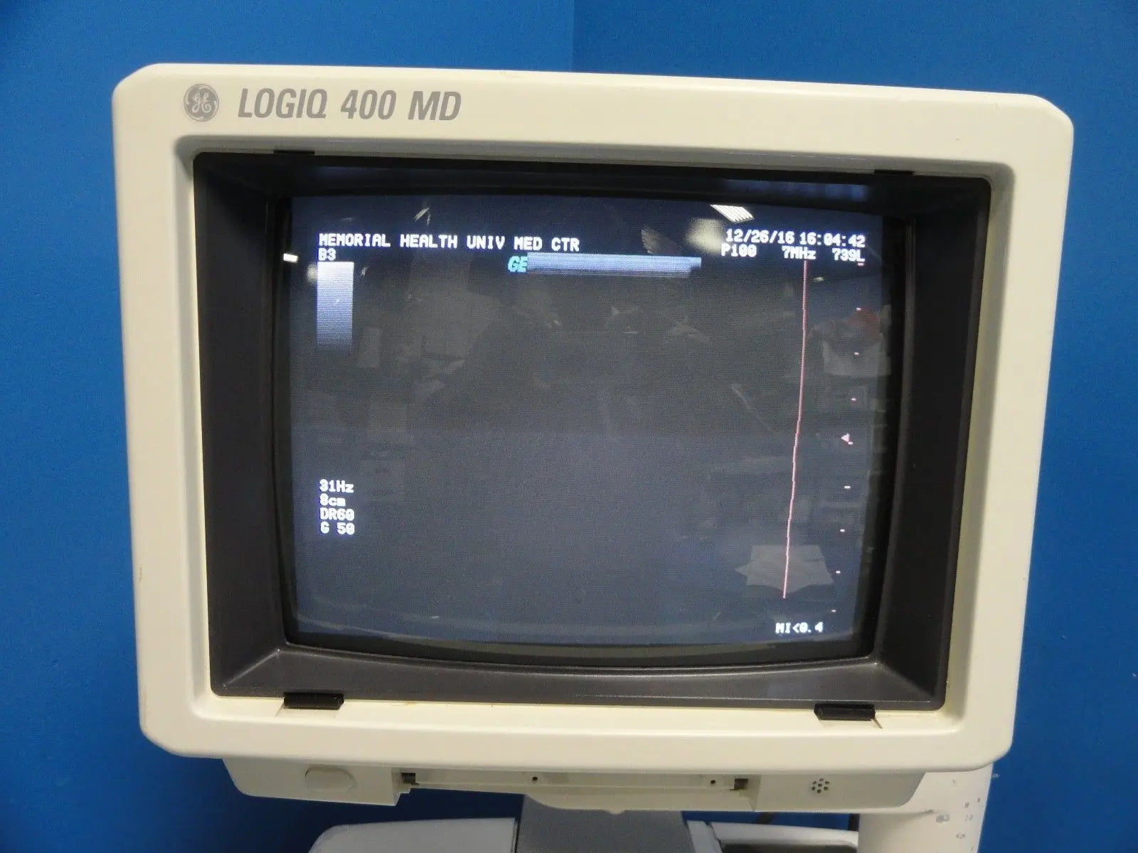 GE Logiq 400 MD Soft Pack Ultrasound W/ C364, C551, 739L  Probes & Printer~12413 DIAGNOSTIC ULTRASOUND MACHINES FOR SALE