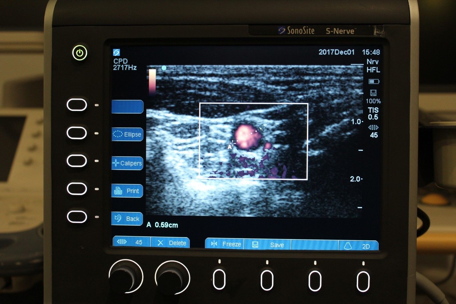 Sonosite S-Nerve vascular/nerve ultrasound with HFL38x-13-6 MHz transducer DIAGNOSTIC ULTRASOUND MACHINES FOR SALE