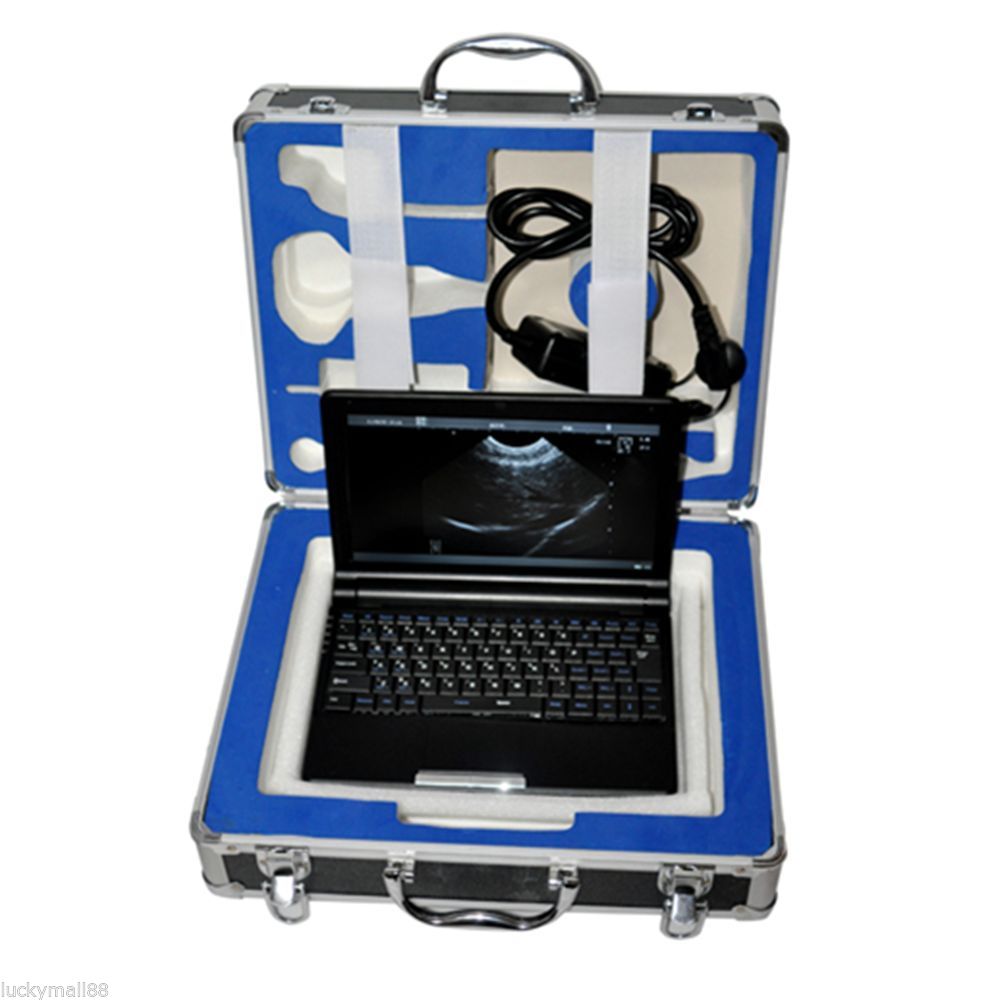Portable Ultrasound Scanner Laptop Machine Convex/Linear/Endovaginal Probe +Case 190891044686 DIAGNOSTIC ULTRASOUND MACHINES FOR SALE