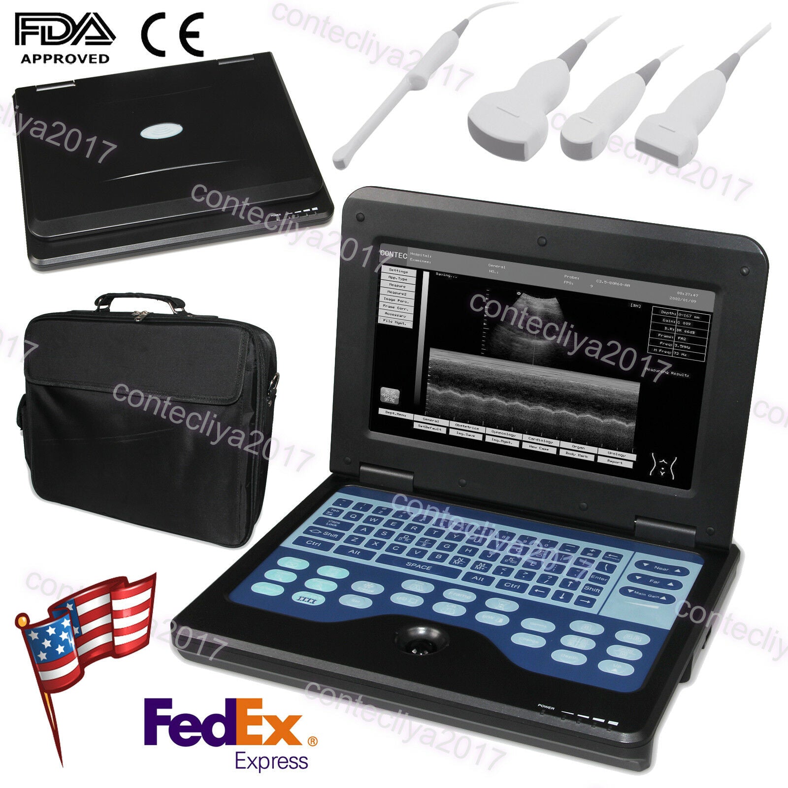 USA,Portable Ultrasound Scanner Laptop Machine Convex/Linear/Cardiac/Tranvaginal DIAGNOSTIC ULTRASOUND MACHINES FOR SALE