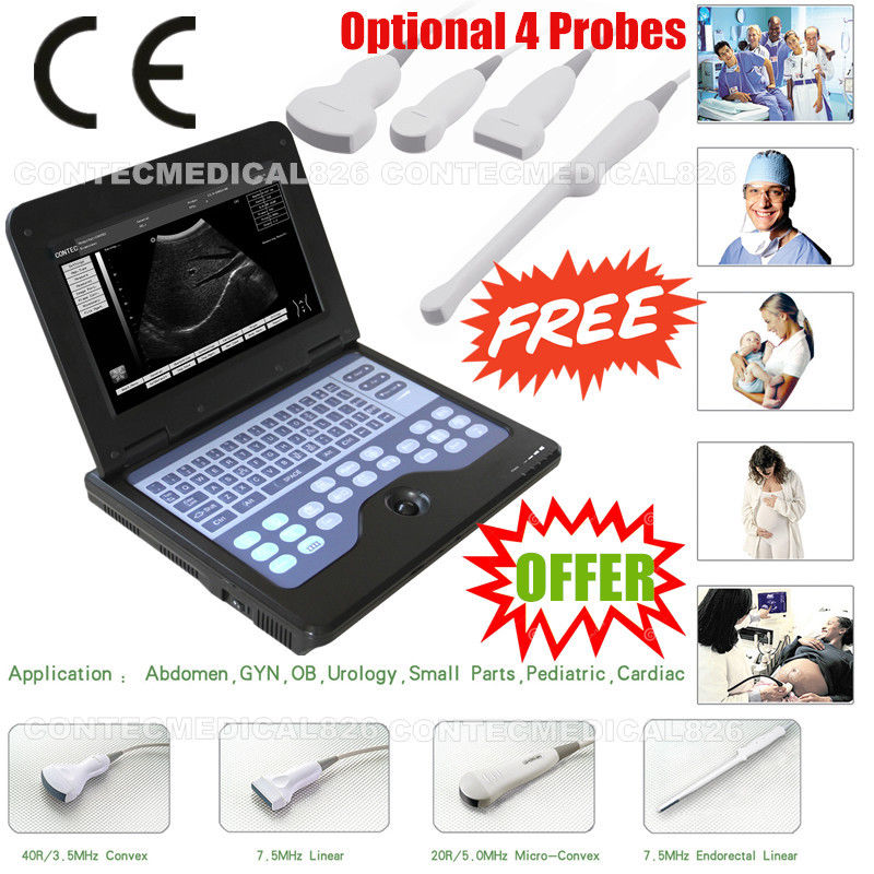 CE Portable Ultrasound Scanner Laptop Machine Diagnostic System Optional 4 Probe DIAGNOSTIC ULTRASOUND MACHINES FOR SALE