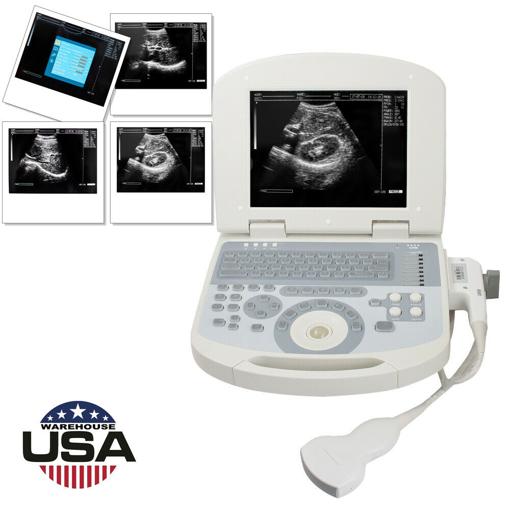 USA 10.4 inch Digital Laptop Medical Ultrasound Scanner 3.5MHZ Convex Probe USA DIAGNOSTIC ULTRASOUND MACHINES FOR SALE