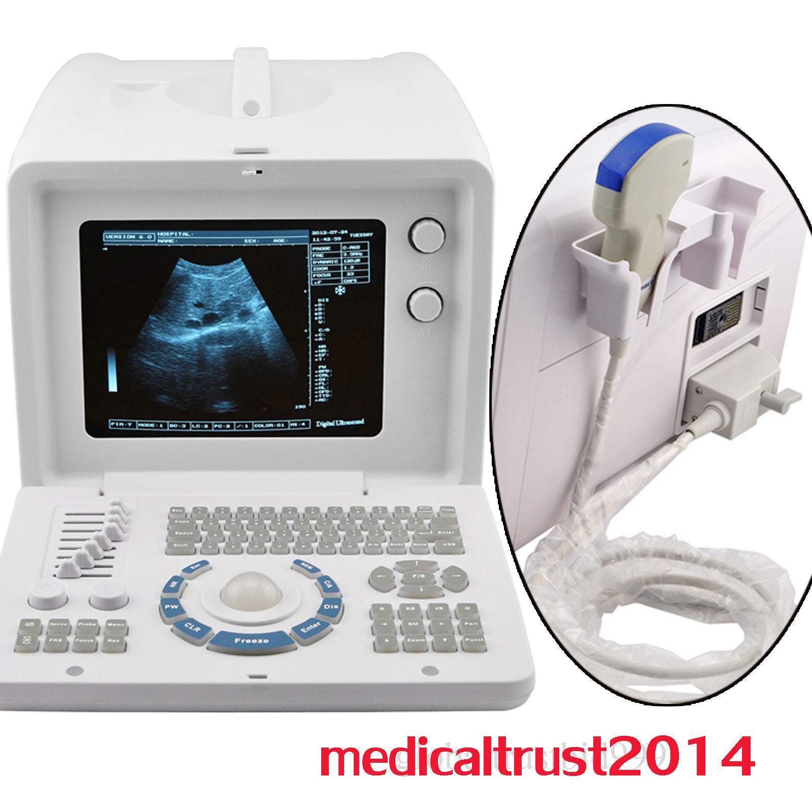 Profession Digital Ultrasound Scanner Convex Probe 3D software Optional Linear 190891927064 DIAGNOSTIC ULTRASOUND MACHINES FOR SALE
