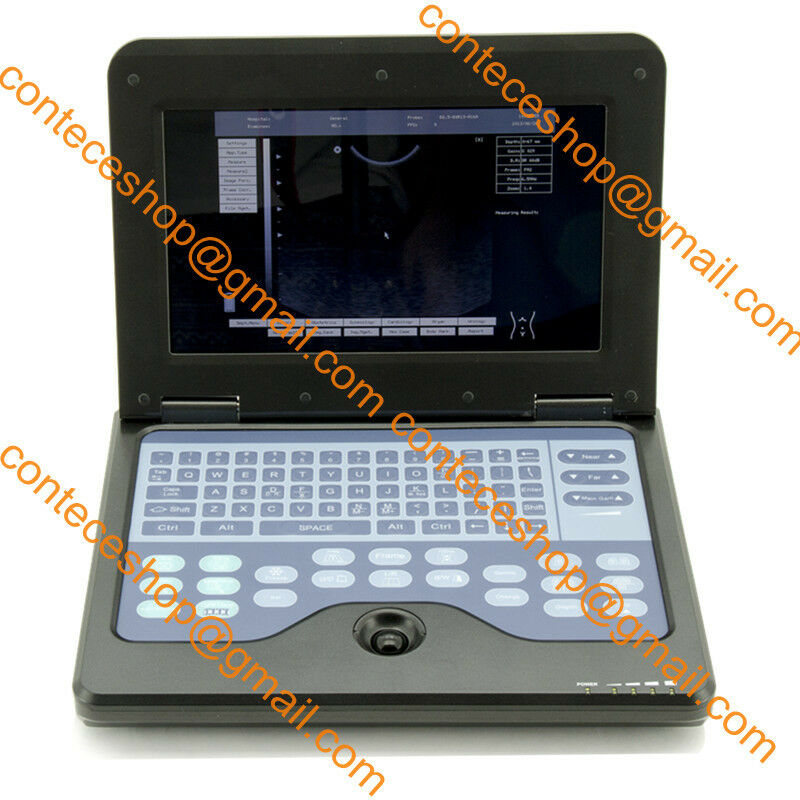 VET Ultrasound Scanner 3.5mhz Convex Probe Laptop Machine Veterinary USA Fedex 658126883672 DIAGNOSTIC ULTRASOUND MACHINES FOR SALE