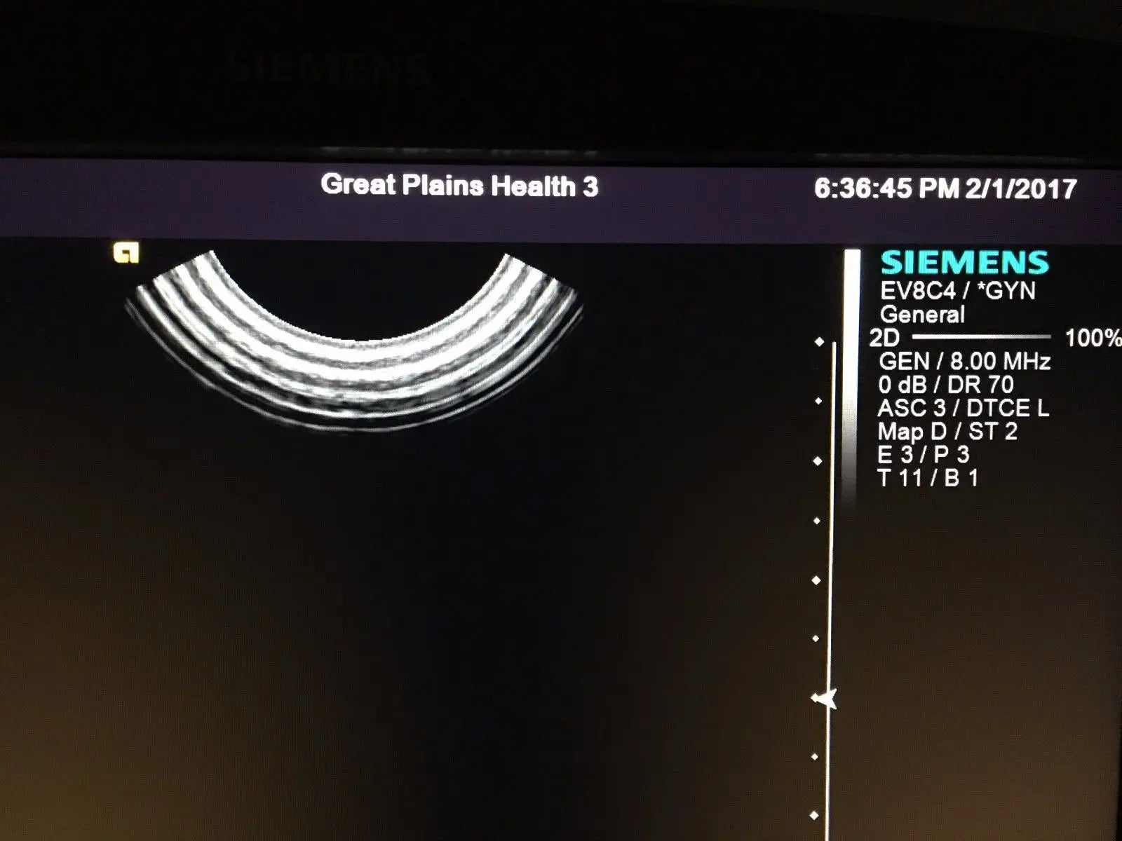 SIEMENS ACUSON S2000 Shared Service Ultrasound w/ 4V1C, 6C2, and EV8C4 Probe DIAGNOSTIC ULTRASOUND MACHINES FOR SALE