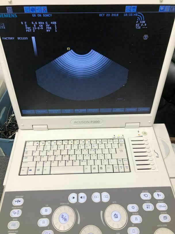 Siemens Acuson P300 Portable Ultrasound Machine with three probes (see below) DIAGNOSTIC ULTRASOUND MACHINES FOR SALE