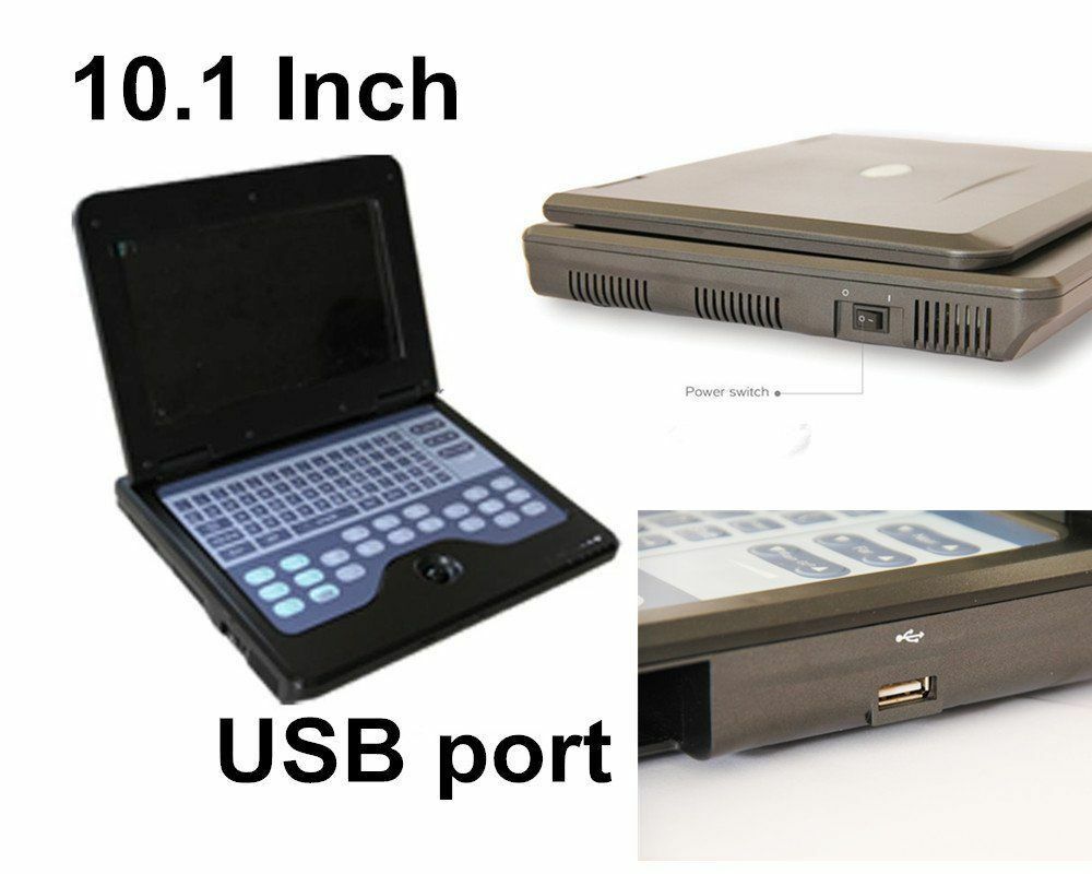 Portable ultrasound scanner laptop machine 3 Probes Convex/ Linear/ Transvaginal DIAGNOSTIC ULTRASOUND MACHINES FOR SALE